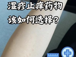 淑芬两腿间又痒痒的用药方法;淑芬两腿间又痒痒的，如何用药？