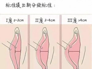 24种阴脣图示 24 种阴脣图示：探索女性私密部位的多样性