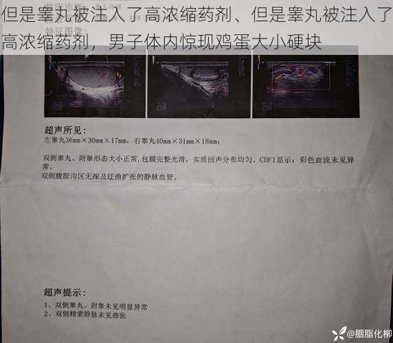 但是睾丸被注入了高浓缩药剂、但是睾丸被注入了高浓缩药剂，男子体内惊现鸡蛋大小硬块