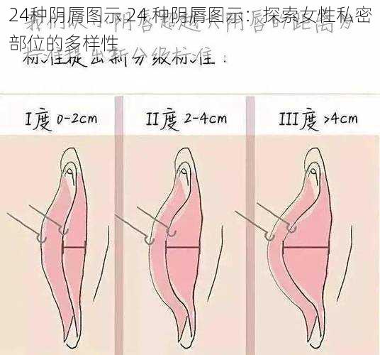 24种阴脣图示 24 种阴脣图示：探索女性私密部位的多样性